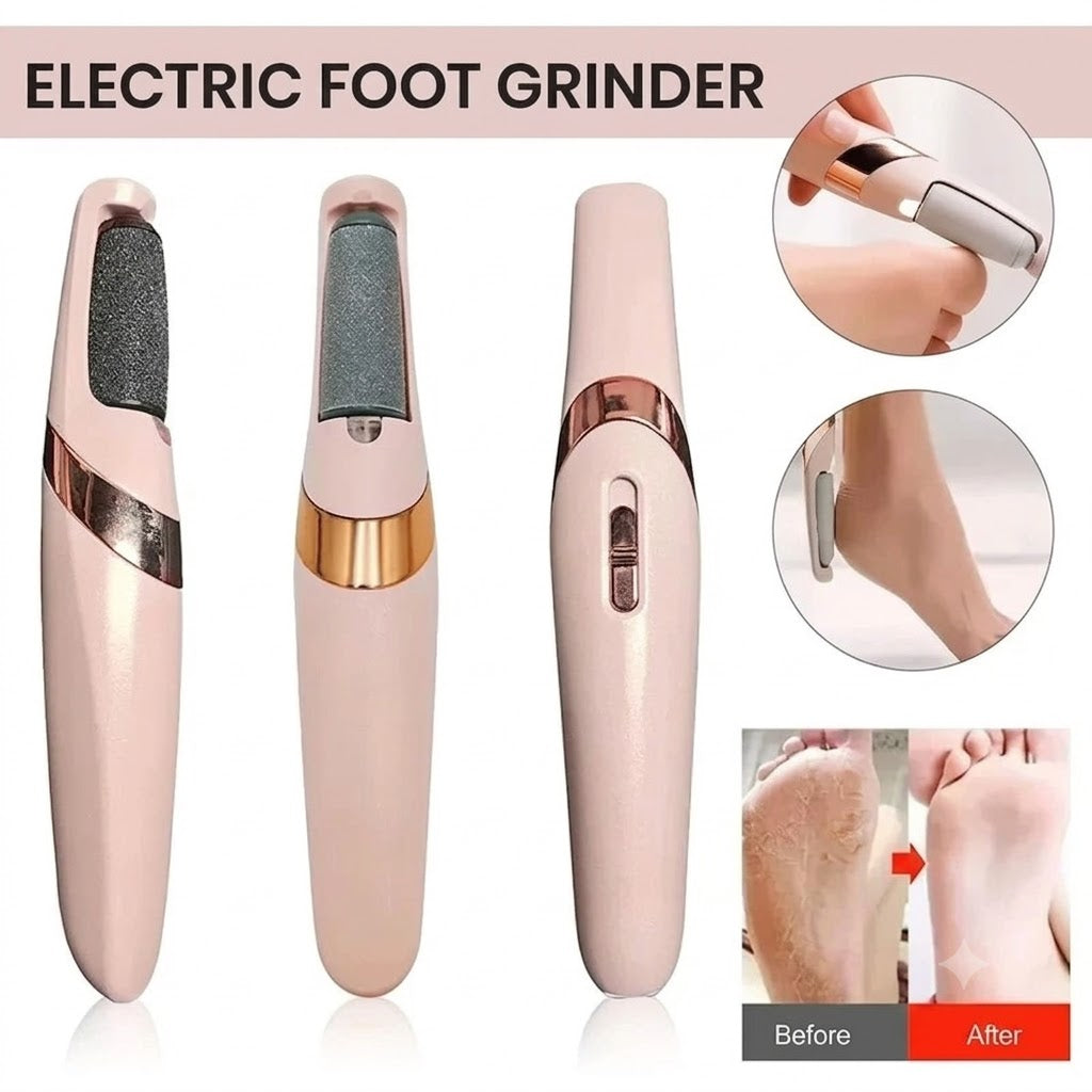 Electric Callus Remover for Feet – Rechargeable Pedicure Kit | Foot Scrubber for Dry, Dead & Cracked Skin ✨ Shinelle